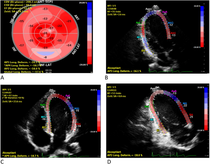 PDF] Myocardial strain imaging: how useful is it in clinical