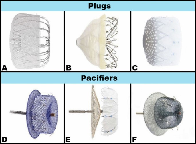 Percutaneous left atrial appendage closure for stroke prevention ...