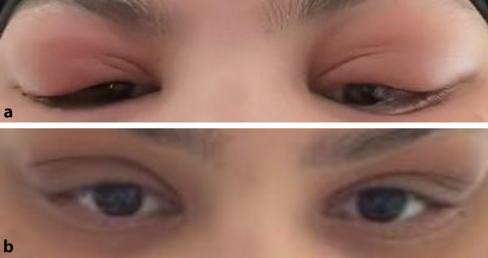 ͼ 1