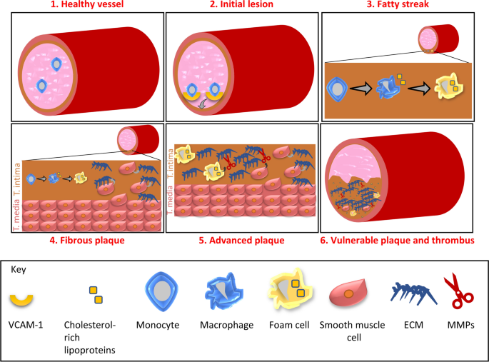 Mouse Models Of Atherosclerosis And Their Suitability For The Study Of Myocardial Infarction Springerlink
