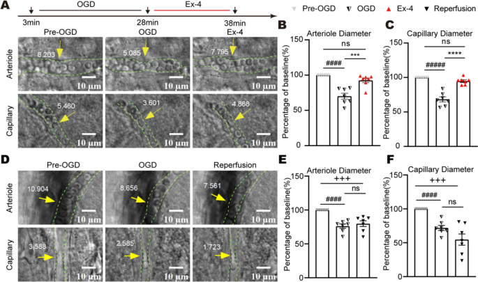 Exendin-4 improves cerebral ischemia by relaxing microvessels, rapidly  increasing cerebral blood flow after reperfusion | Basic Research in  Cardiology | Springer Nature Link