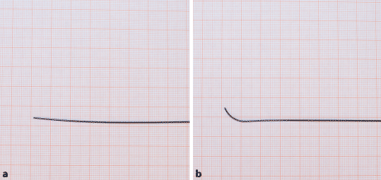 Wire Skills Zur Transkatheter Aortenklappenimplantation Springerlink