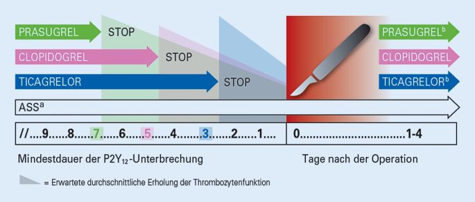 Antikoagulation und Thrombozytenaggregationshemmung beim herzchirurgischen  Patienten | SpringerLink