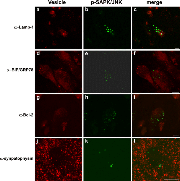 Relation of hippocampal phospho-SAPK/JNK granules in Alzheimer's