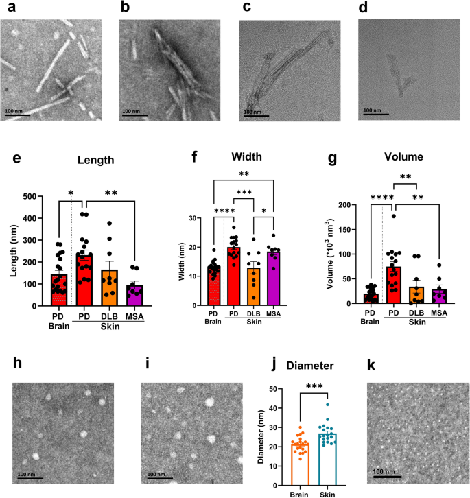 Biochemical signatures of skin α-synuclein in synucleinopathies ...