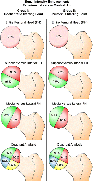 The effect of antegrade femoral nailing on femoral head perfusion: a comparison of piriformis fossa and trochanteric entry points | SpringerLink The effect of antegrade femoral nailing on femoral head perfusion: a comparison of piriformis fossa and trochanteric entry points | SpringerLink