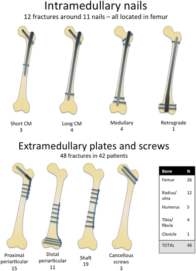waterfall Choice Various Non-prosthetic peri-implant fractures: classification, management and  outcomes | SpringerLink