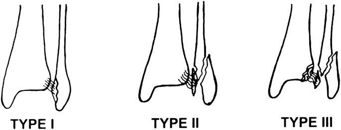 figure1