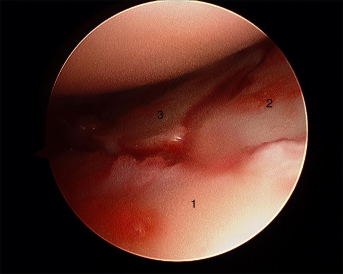 figure18