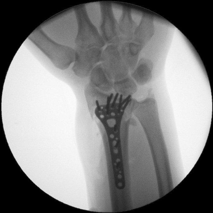 figure19