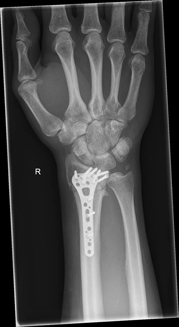 figure21