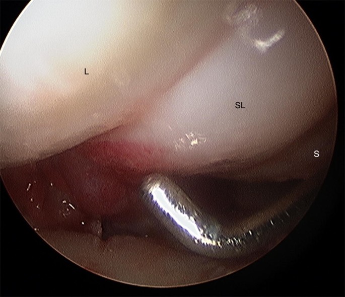 figure7