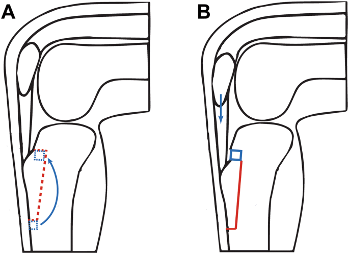 figure1