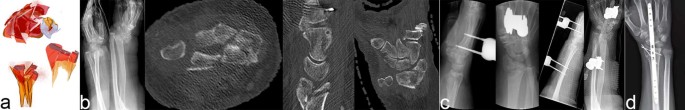 figure22