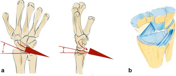 figure2
