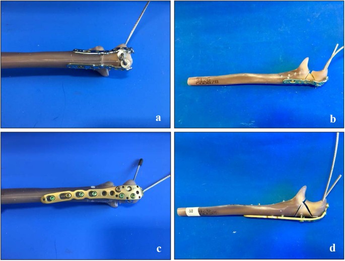 figure1