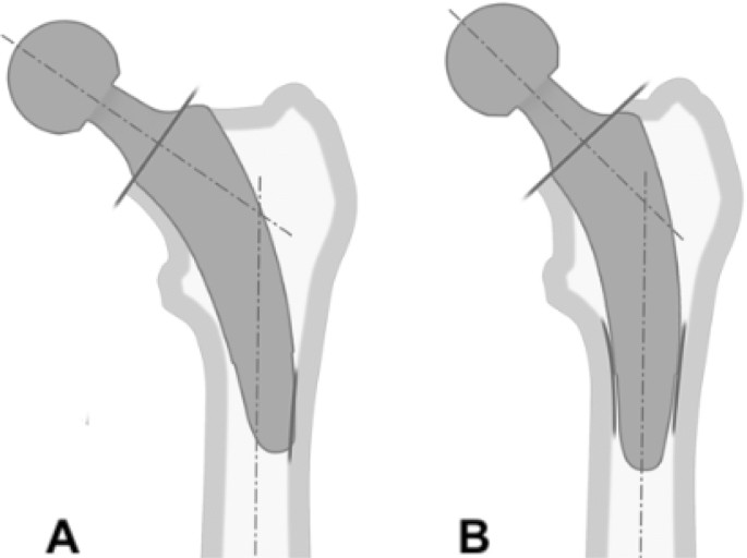 figure4