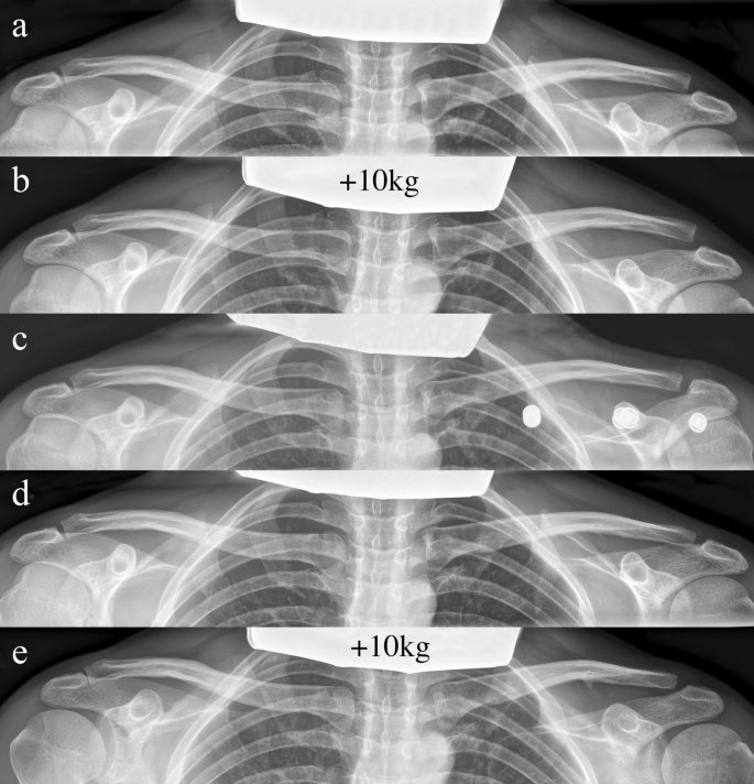 figure2