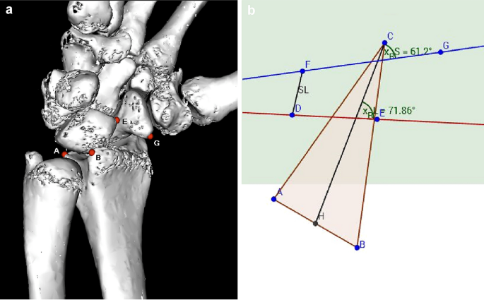 figure1