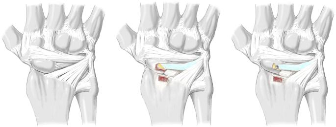 figure3