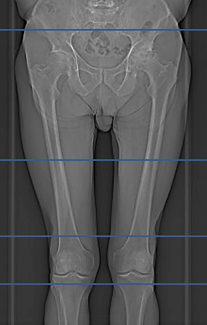 The X-ray scanner is used to investigate a discrepancy in sex