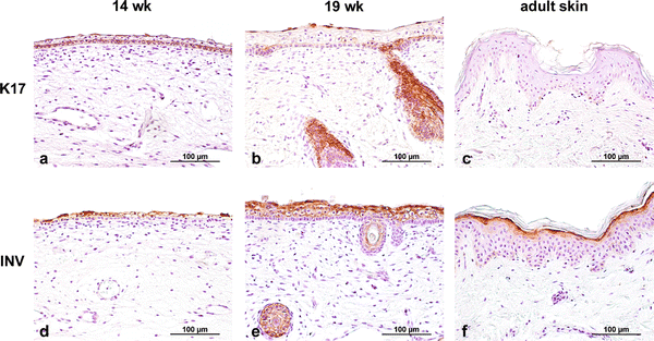 Comparison between human fetal and adult skin | SpringerLink