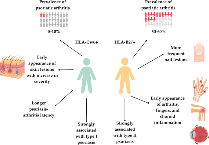 The influence of genetic factors on the clinical manifestations and ...