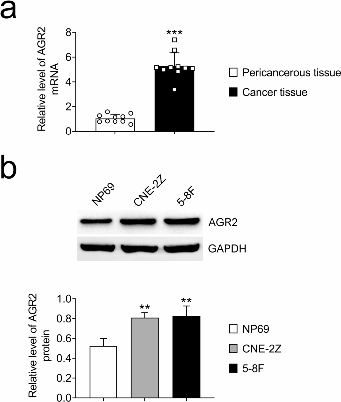 AGR2 activates the TGF-β/Smad signaling pathway to promote epithelial ...