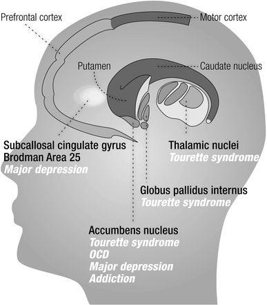 figure1