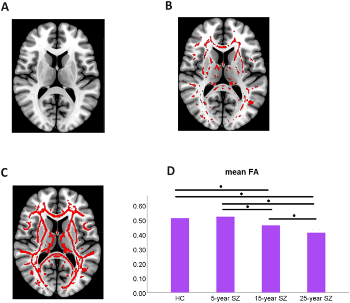 Cognitive impairment and associated white matter organization ...