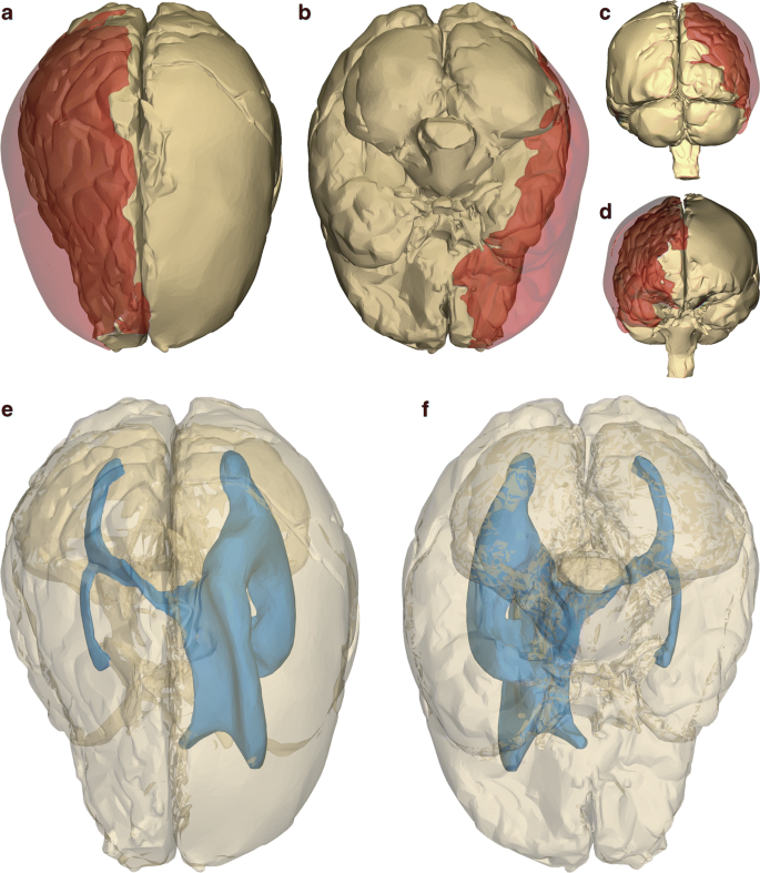 2d to 3d conversion in cortex 2d to 3d conversion in cortex