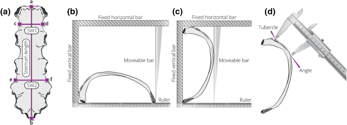 New Methods For Sex Estimation Using Sternum And Rib