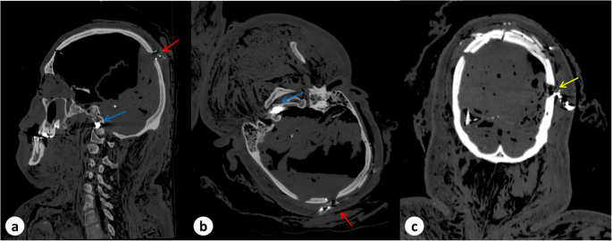 figure 16