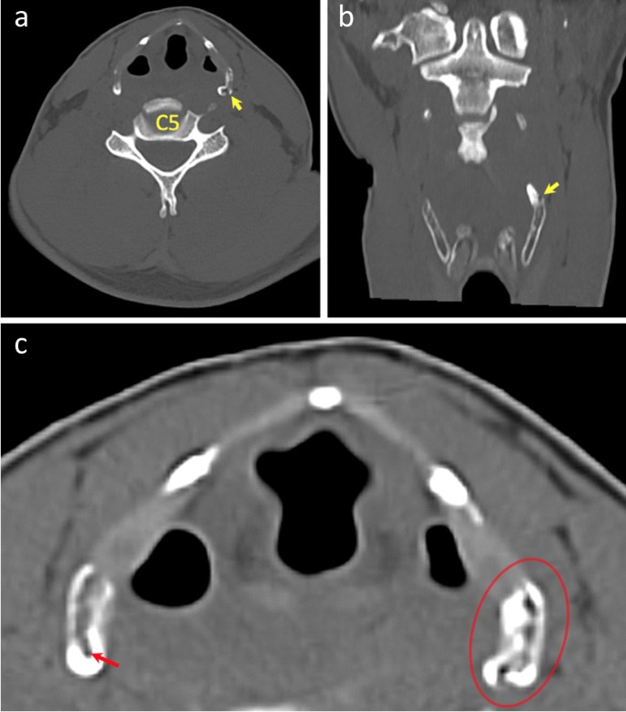 figure 14