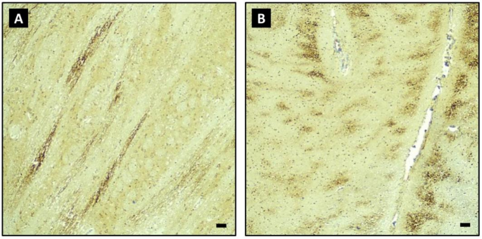 Comparison of background characteristics and neuropathology findings ...