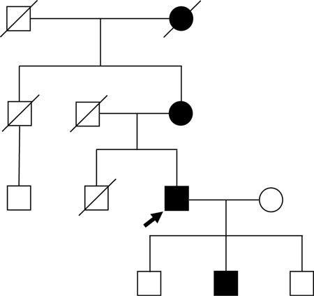 Mutation Of The Highly Conserved Cysteine Residue 131 Of The Sca14 Associated Prkcg Gene In A Family With Slow Progressive Cerebellar Ataxia Springerlink