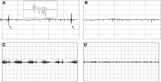 Strahlen Überschuss Abgabe x med classic αδιαβροχα 10 strips  Sonnenfinsternis Inland Trivial