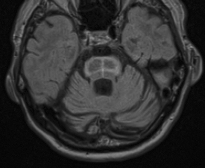 Hot Cross Bun Sign Springerlink