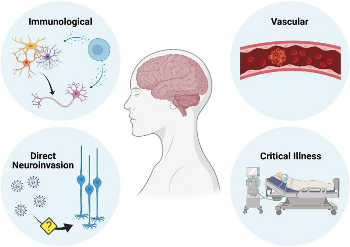 Neurological update: COVID-19 | SpringerLink