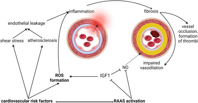 Endothelial dysfunction in acute ischemic stroke: a review | Journal of ...