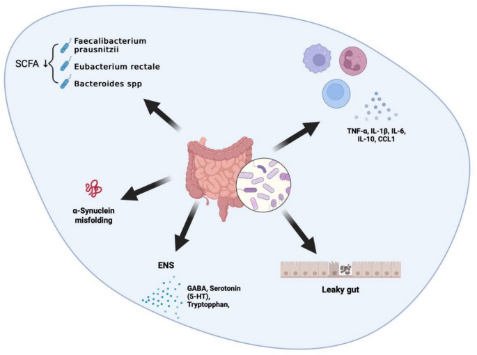 The role of the gut microbiome in the progression of Parkinson’s ...