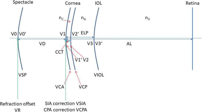 The Castrop formula for calculation of toric intraocular lenses |  SpringerLink