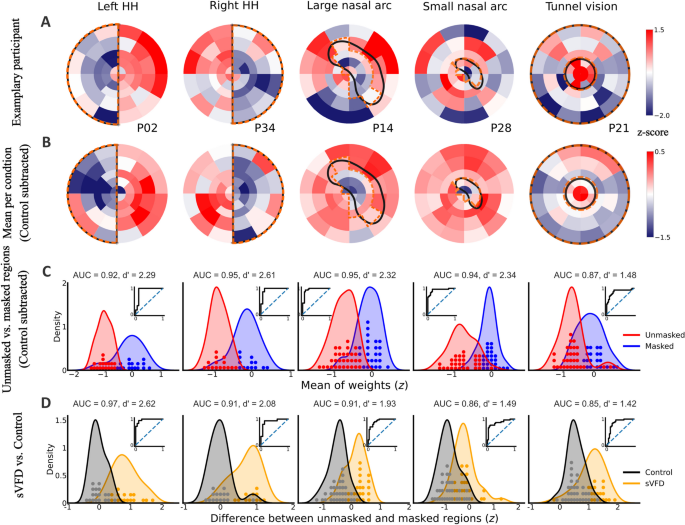 Mapping simulated visual field defects with movie-viewing pupil ...