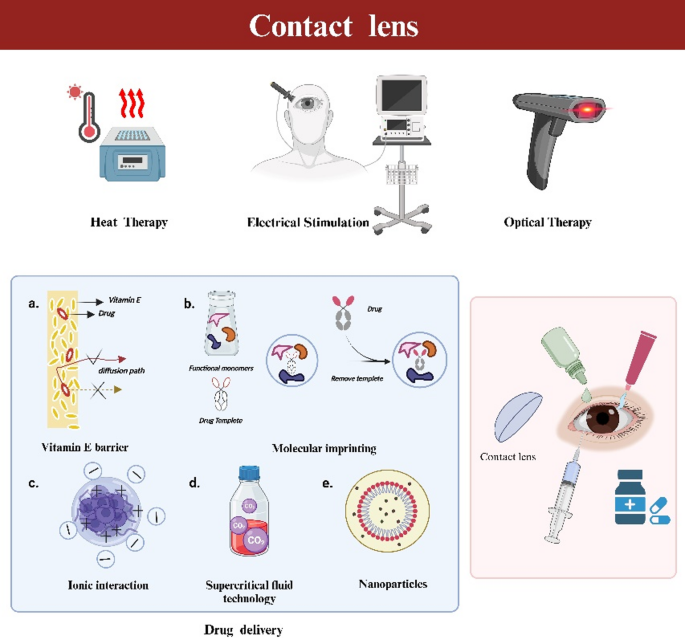Smart contact lenses: recent advances and future challenges in eye ...