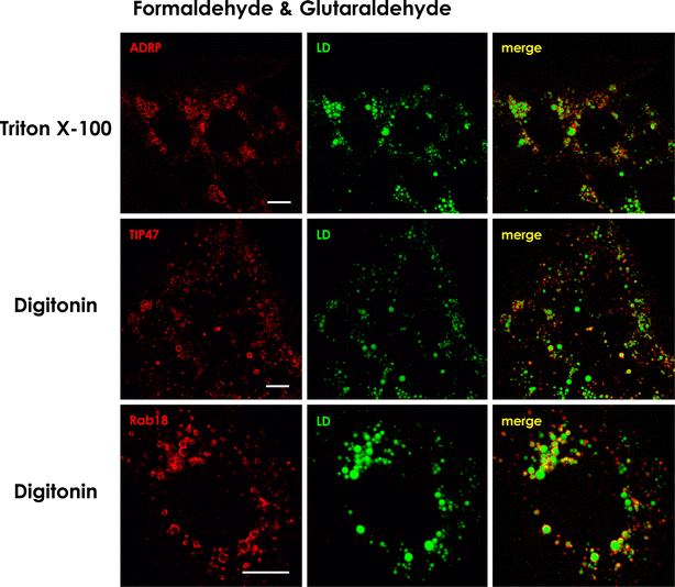 Fixation And Permeabilization Protocol Is Critical For The Immunolabeling Of Lipid Droplet Proteins Springerlink