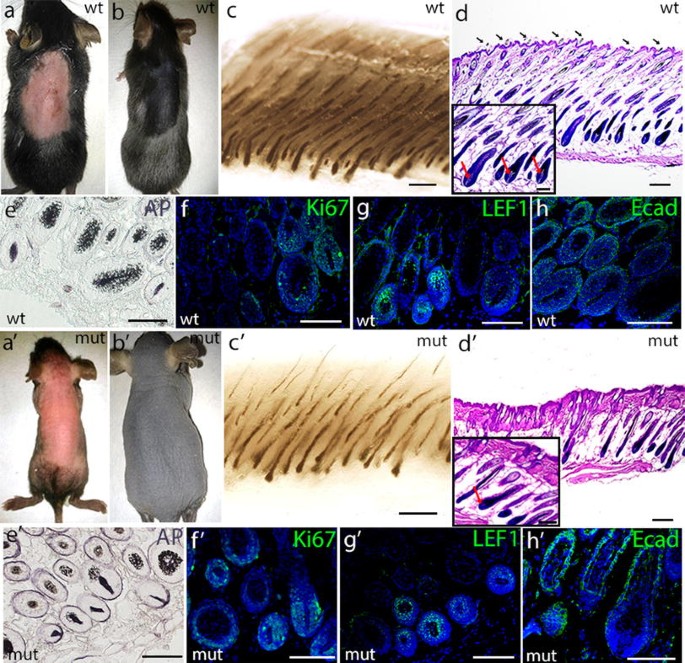 Hair follicle morphogenesis and epidermal homeostasis in we/we wal/wal mice  with postnatal alopecia | SpringerLink