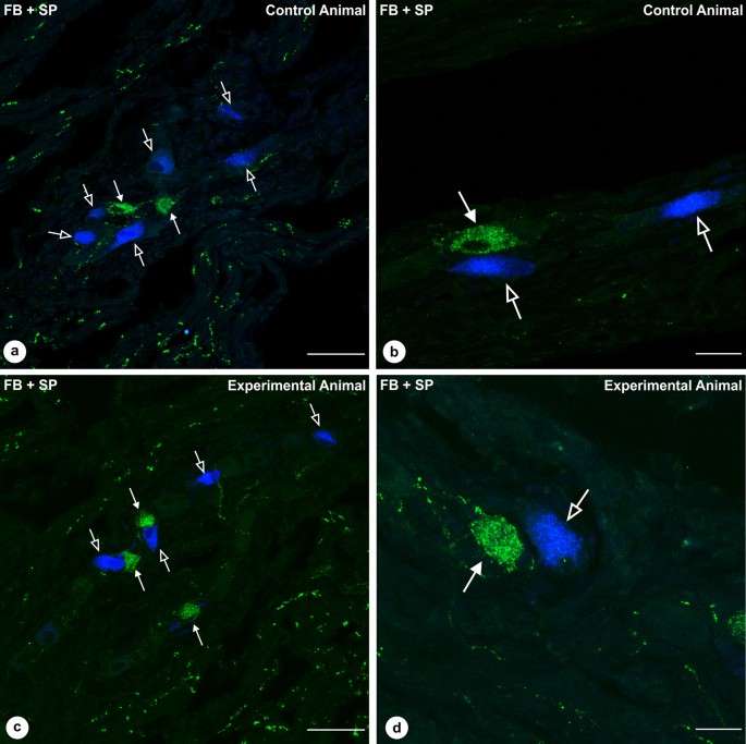Gastric Ulcer Induced Changes In Substance P And Nk1 Nk2 Nk3 Receptors Expression In Different Stomach Localizations With Regard To Intrinsic Neuronal System Springerlink
