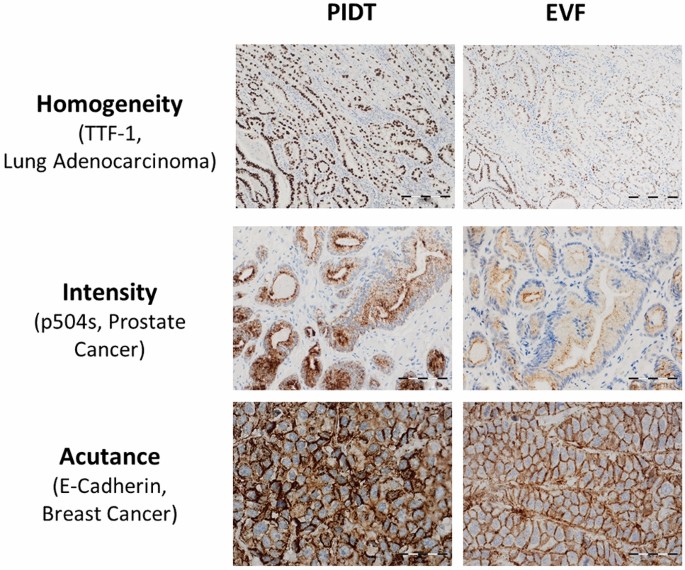 Critical assessment of staining properties of a new visualization  technology: a novel, rapid and powerful immunohistochemical detection  approach | Histochemistry and Cell Biology