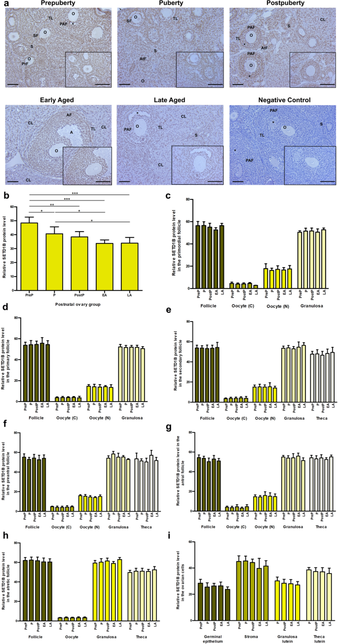 Histone methyltransferases Setd1b increases H3K4me3 level to