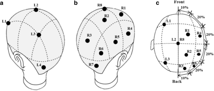 Sweating Distribution And Active Sweat Glands On The Scalp Of Young Males In Hot Dry And Hot Humid Environments Springerlink
